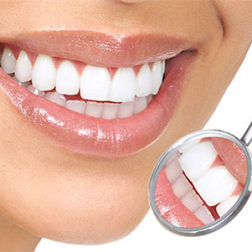 Cạo Vôi Đánh Bóng/ Trám Răng Tại Nha Khoa STO
