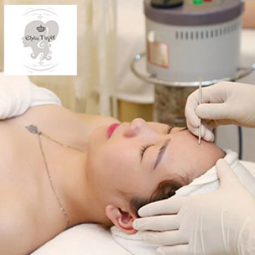 Lấy Sạch Nhân Mụn, Điều Trị Mụn, Trị Thâm Bằng Công Nghệ...
