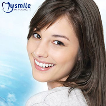 Lấy Cao Răng + Đánh Bóng Răng + Chấm Thuốc viêm lợi Và Tư Vấn...