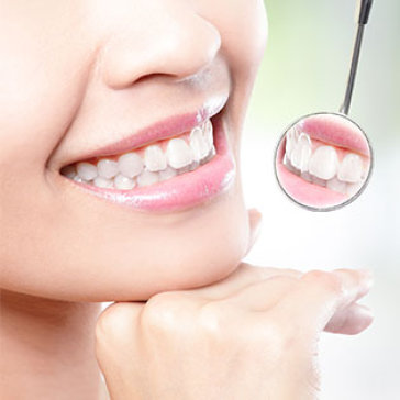 Dịch Vụ Cạo Vôi, Đánh Bóng Răng Tại Nha Khoa Đông Kinh