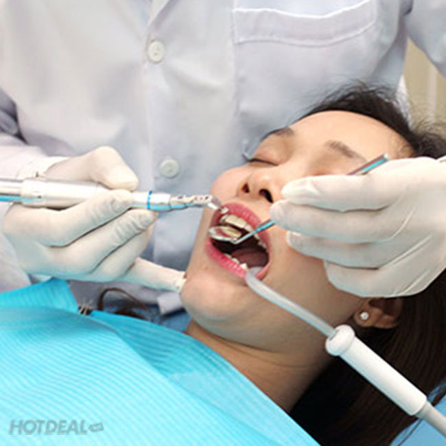 Răng toàn sứ Cercon Zirconia - Bảo Hành 10 Năm - Nha Khoa Đại Sứ