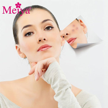 Điều Trị Mụn Tận Gốc Bằng Ánh Sáng Sinh Học Tại Meiya Spa