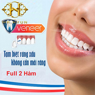 DEAL HOT Phủ Răng Sứ Full 2 Hàm Diamond Nano White – Sứ Veneer Châu Âu Tại Thẩm Mỹ Mr Hyun