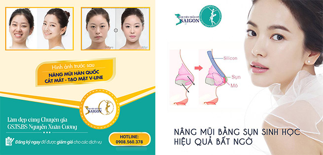 Nâng Mũi Sụn Cấu Trúc L-Line Tây Hot Nhất 2019 Tại Bệnh Viện Thẩm Mỹ Sài Gòn Nổi Tiếng Sài Gòn - GS.TS Nguyễn Xuân Cương