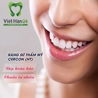 Răng Sứ Cercon HT (USA) BH 20 Năm, Camera Nội Soi, Cạo Vôi Răng Hệ Thống Nha Khoa Quốc Tế Việt Hàn 04