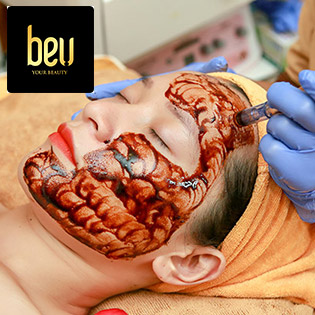 Cấy Tảo Xoắn/ Hồng Sâm/ Ủ Trắng Mặt/ Lăn Kim Siêu Vi Điểm Trị Sẹo Rỗ, Nám, Tàn Nhang - Cam Kết Hiệu Quả 100% - Hệ Thống BeU Spa