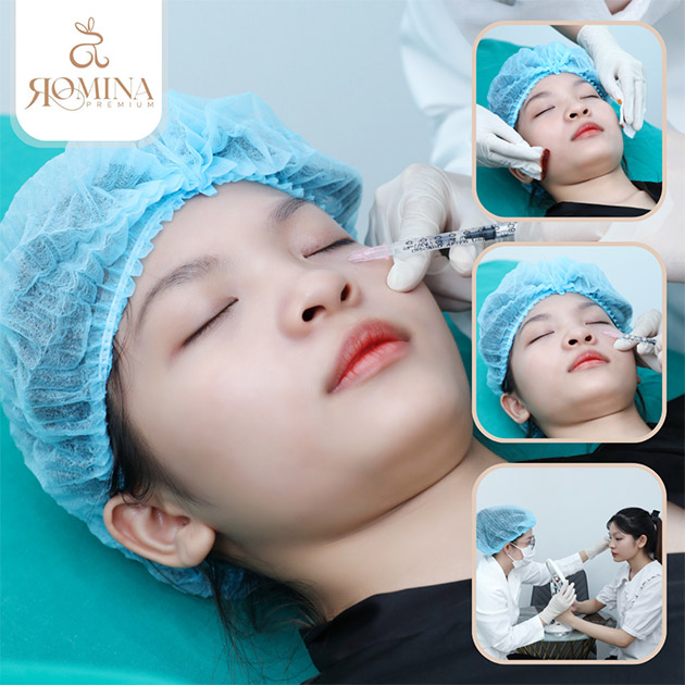 VTM Romina Premium - Căng Bóng Da Mesotherapy Châu Âu