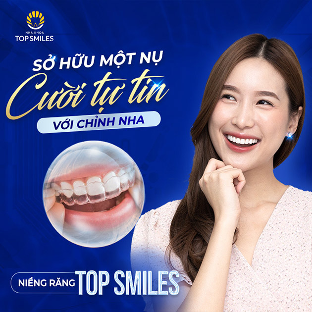 Top Smiles - Cạo Vôi + Trám Răng + Voucher 34Tr Giảm Giá Niềng Răng