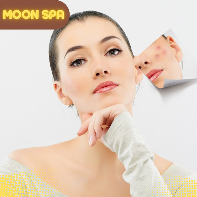 Golden Moon Spa - Trị Mụn Chuẩn Y Khoa (Tặng Massage Cổ Vai Gáy)