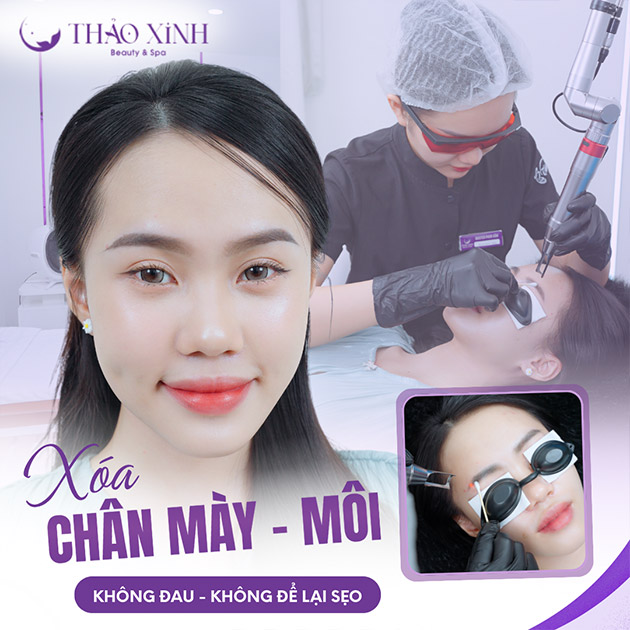 VTM Thảo Xinh - Xóa Chân Mày, Môi Không Đau, Không Để Lại Sẹo
