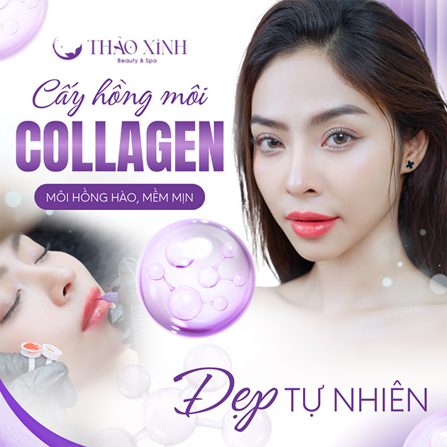 VTM Thảo Xinh - Cấy Hồng Môi Collagen - Đẹp Tự Nhiên