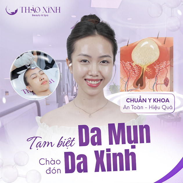 VTM Thảo Xinh - Trị Mụn Chuẩn Y Khoa + Chăm Sóc Da - Hiệu Quả