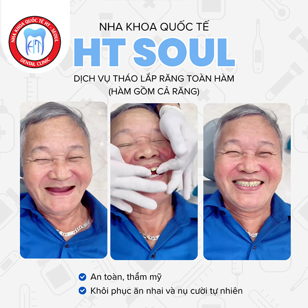 Nha Khoa HT Seoul - Tháo Lắp Toàn Hàm (Hàm Gồm Cả Răng)