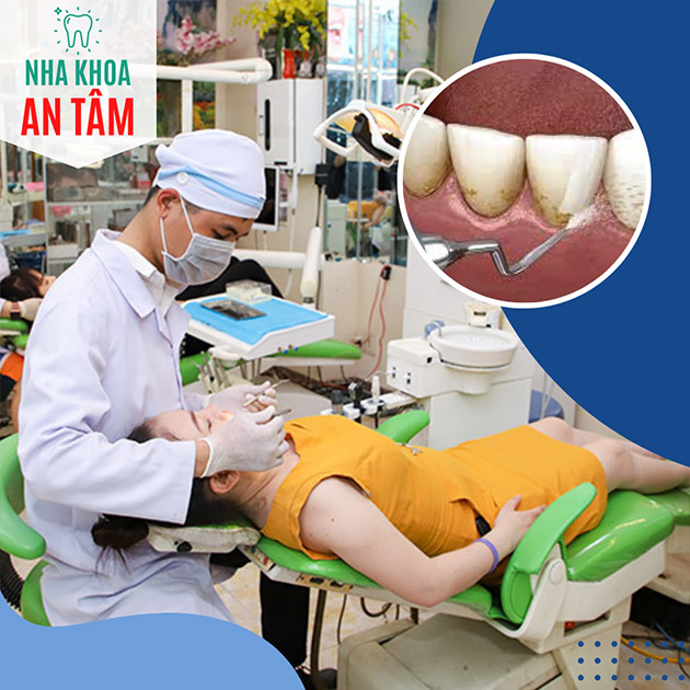 Nha Khoa An Tâm - Cạo Vôi, Đánh Bóng/ Trám Răng Chất Lượng Cao