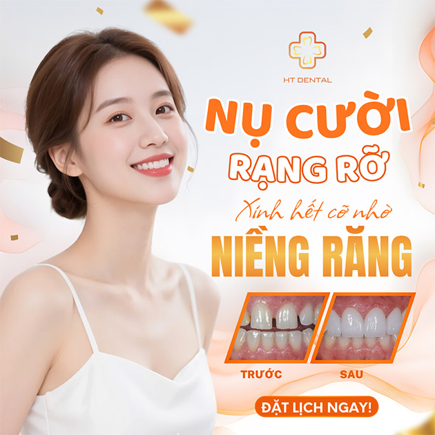 Niềng Răng Bằng Mắc Cài Kim Loại Tự Buộc - Nha Khoa HT