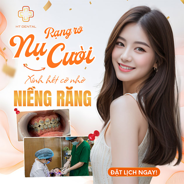Niềng Răng Bằng Mắc Cài Kim Loại Chuẩn - NHA KHOA HT