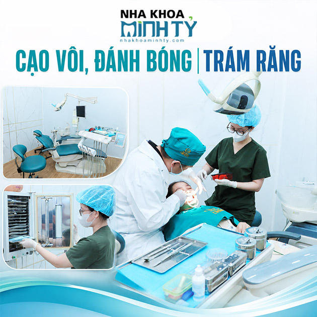 Nha Khoa Minh Tỷ - Cạo Vôi, Đánh Bóng/ Trám Răng