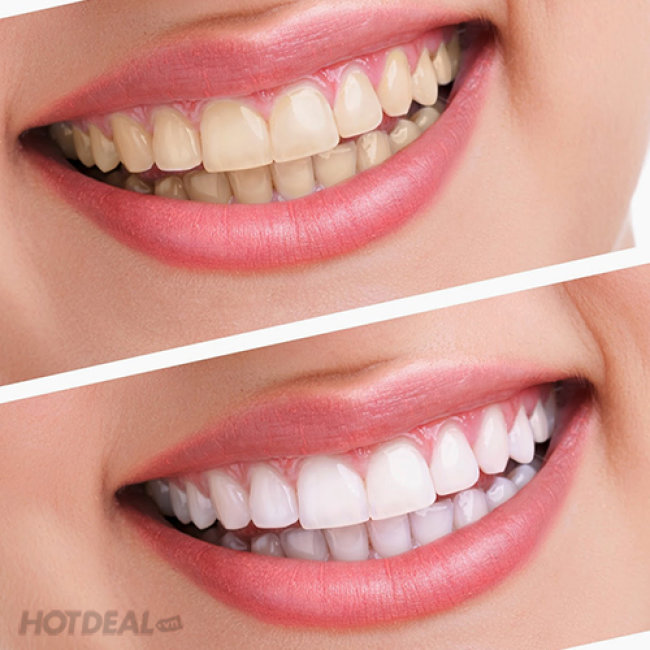 Kết quả hình ảnh cho nha khoa răng hàm mặt hotdeal
